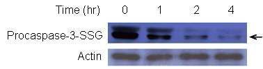 Effects of doxorubicin (DOX) on glutathiolated procaspase-3. Glutathiolation of procaspase-3 significantly decreased by DOX in a time dependent manner.