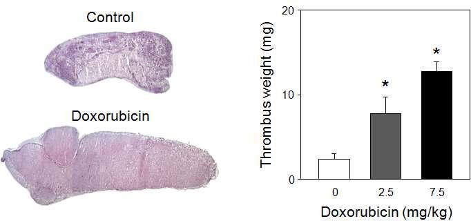 After intravenous infusion of DOX, FeCl3 was infused for thrombus formation. Stasis-induced thrombosis was induced in the vena cava, and then isolated thrombus was weighed.