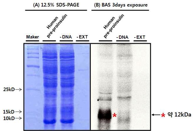 동위원소 (35S)를 이용한 in vitro TNT 반응 후의 SDS-PAGE 분석