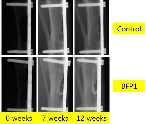 BFP1의 가토에서 효과에 대한 X-ray 분석