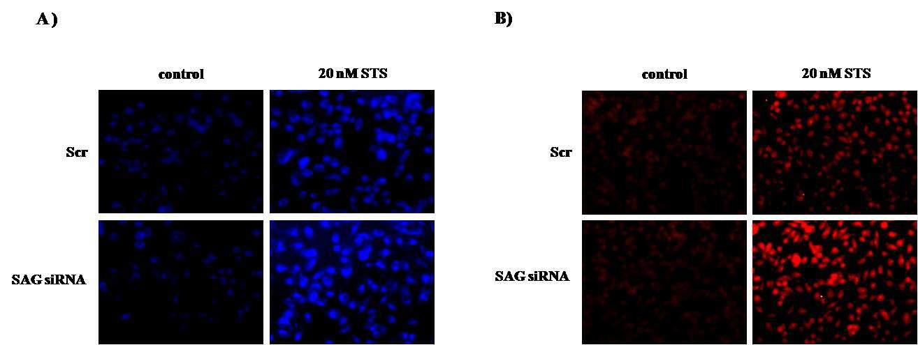 Lipid peroxidation and 8-OH-dG adduct generation of DNA by staurosporine in SAG siRNA transfectant PC3 cells