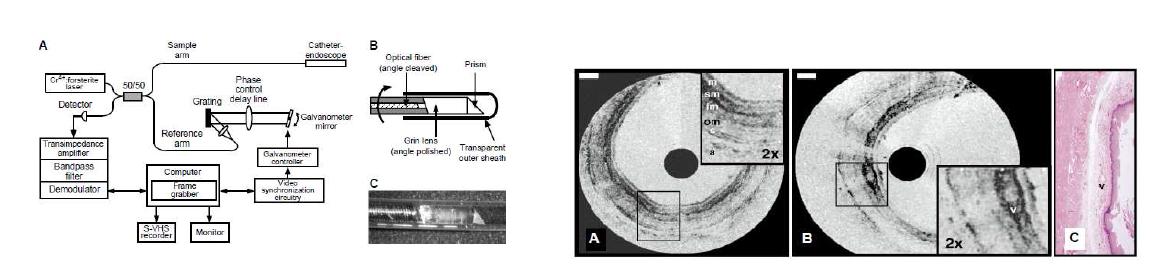 광섬유와 초소형 프리즘 모듈 회전 스캔 방식의 OCT 내시경 시스템 개략도 및 획득한 rabbit esophagus 이미지