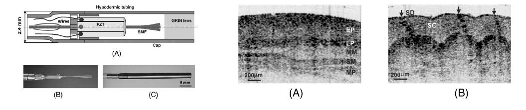 Piezoelectric 튜브를 이용한 광섬유 스캔 방식의 내시경 구조 및 획득된 손가락 이미지