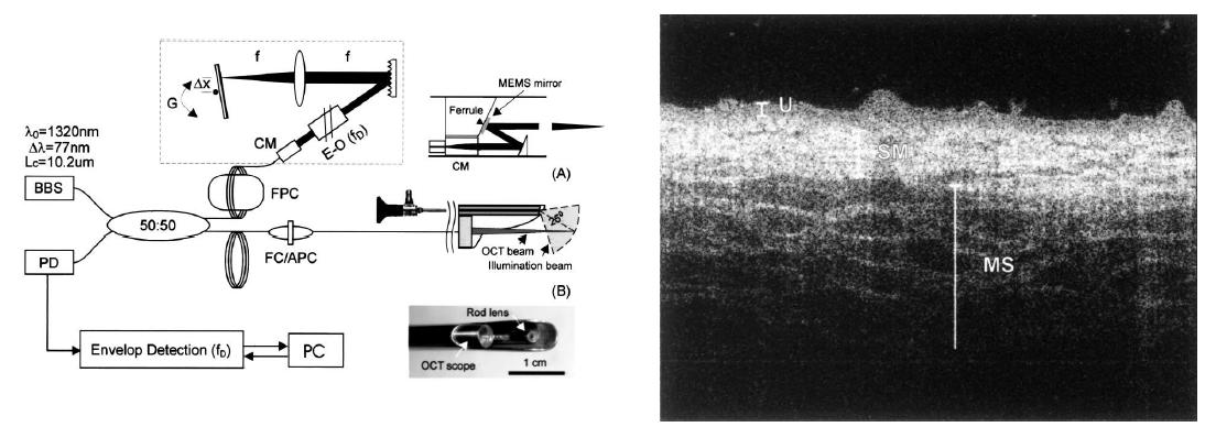 처음으로 개발된 MEMS 미러 기반 OCT 내시경 시스템 개략도 및 영상