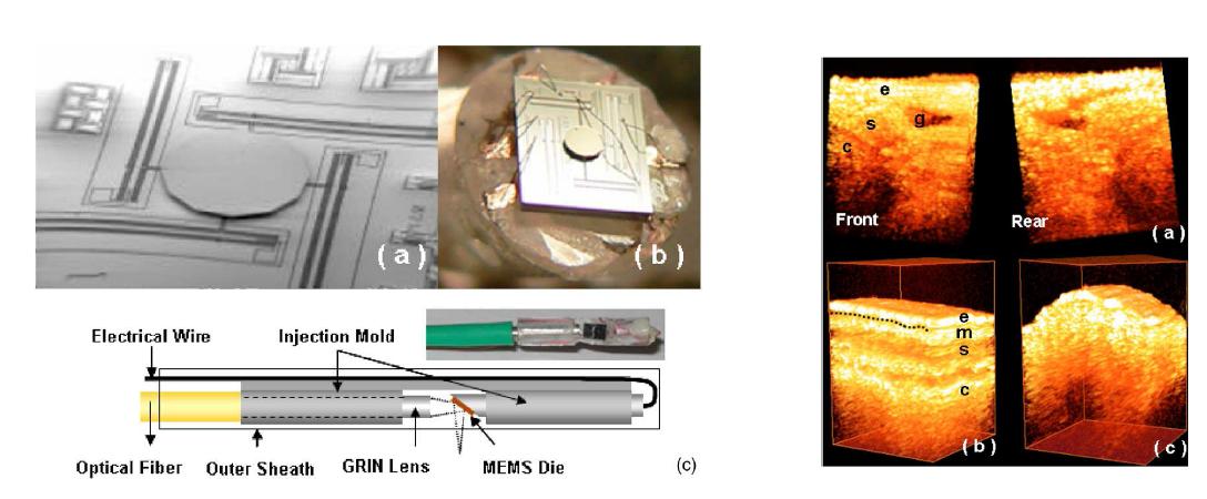 Electro-static dual axis scanning MEM S 미러 기반 OCT 내시경 시스템 개략도 및 3D rabbit trachea image