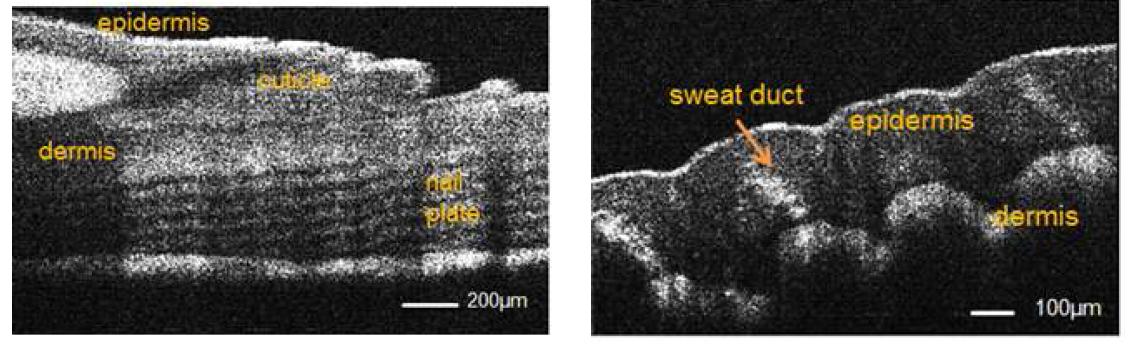 인간 피부 조직의 SD-OCT 절편 영상. (좌) Human nail fold, (우) Human fingerprint