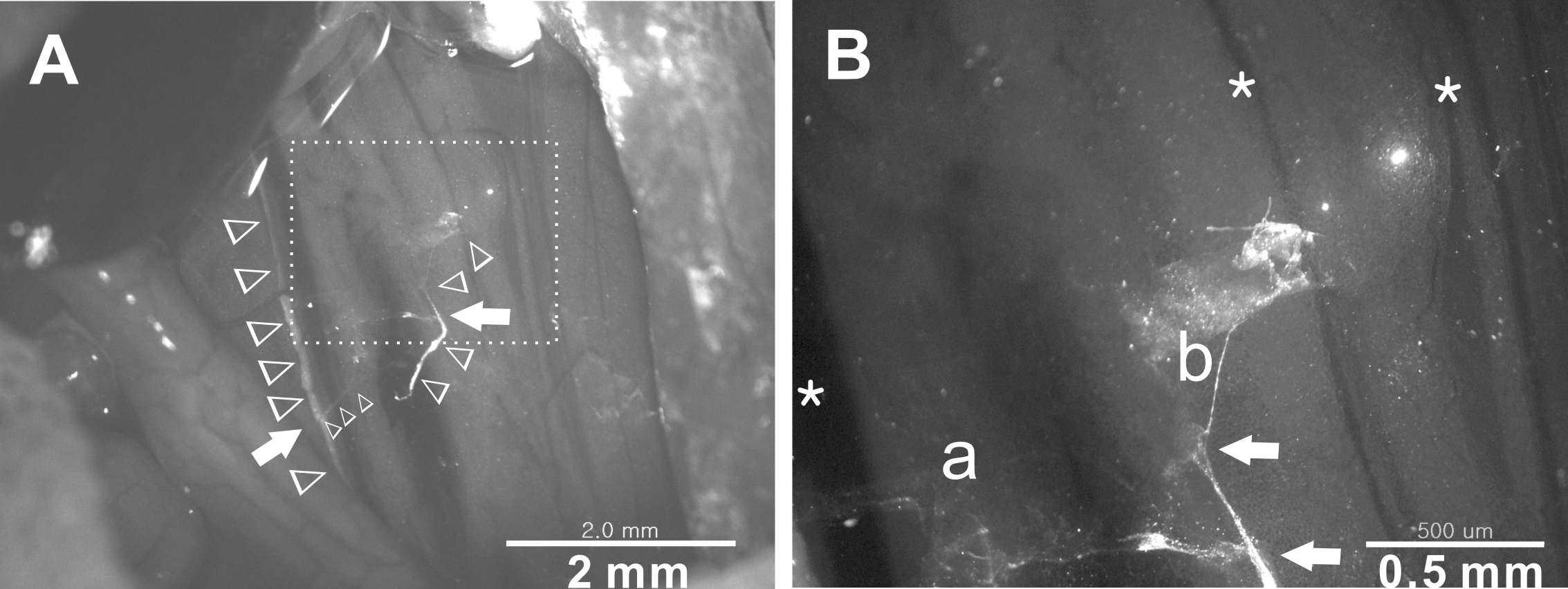 DiI-labeled organ surface BHD in deep abdomen of rat