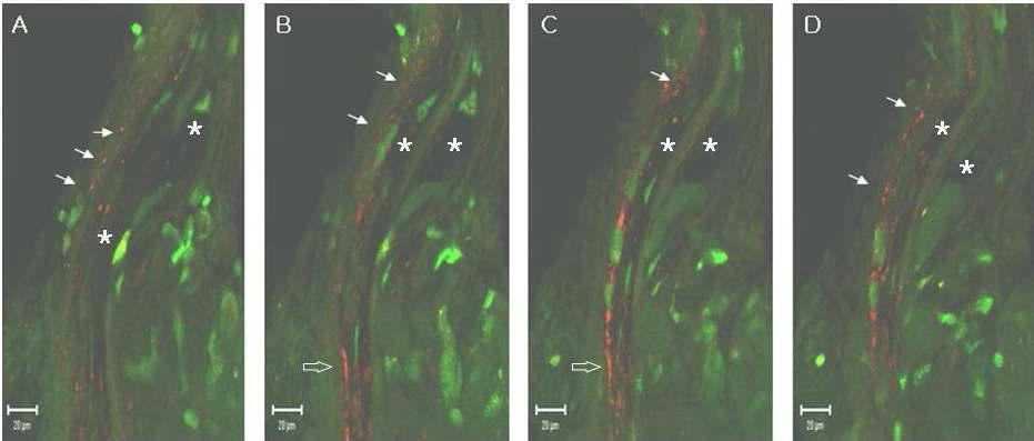 Confocal Laser Scanning Microscopic images of DiI of Bonghan duct containing DiI (red fluorescence, arrows) on small intestine of rat