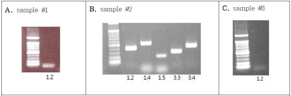 림프관에 존재하는 봉한소체(BHC) 및 봉한관 (BHD)에서 전압의존성 K채널 발현 (PCR product)