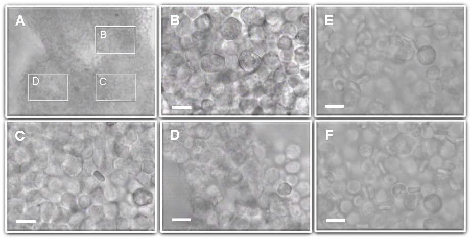 A. a BHC slice (200 ㎛) filled with round BHC cells (100×). B-D, Enlarged images of the area marked in A (400×). Note a RBC in the middle of C. E and F, red blood cells seen in slices of BHC that contain relatively large number of RBC. Scale bars = 10 ㎛.