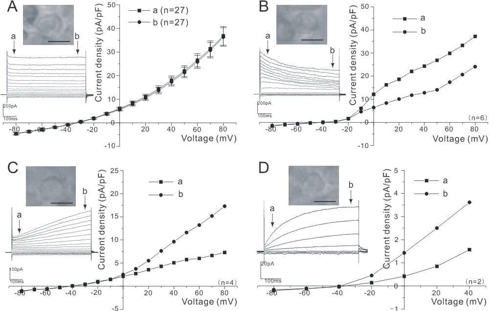 Four types of current-voltage (I-V) relations recorded from cells in BHC slice.