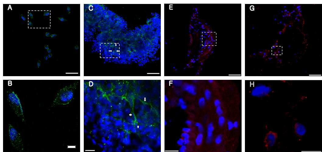 Immunoreactivity of CK10 in Hela cell (A and B), Bonghan tissue (C and D), blood (E and F) and lymphatic vessels (G and H). CK10 immunoreactivity is presented as green (A~D) or red (E ~ G), and DAPI staining for DNA as blue.