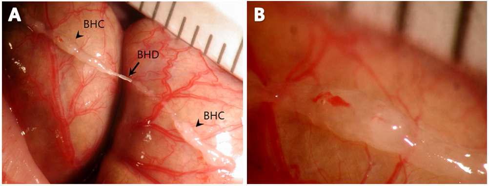 Stereomicroscopic images of the primo-vascular tissue composed of the primo-vessels (BHD, Bonghan duct), and primo-nodes (BHC, Bonghan corpuscle) on the surface of rat large intestine