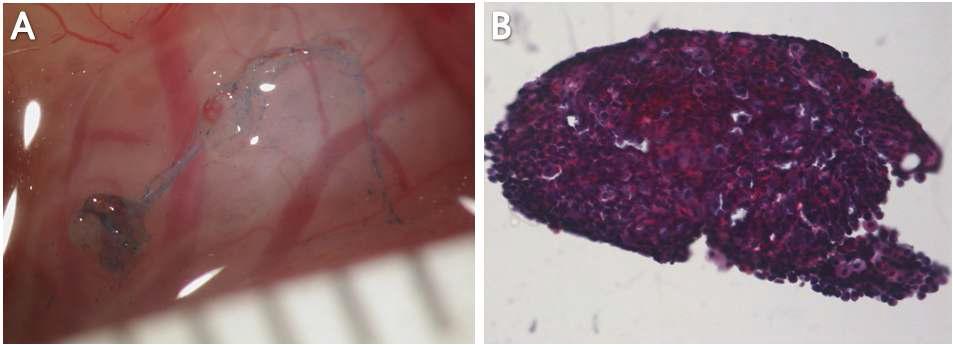 Staining of primo-vascular tissues with Trypan blue and H&E.