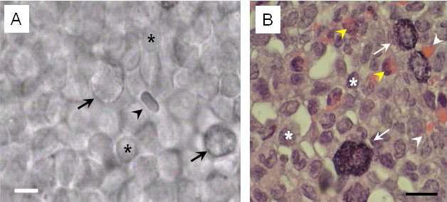 Three types of cells in the organ surface primo node in slice and thin section stained by H&E