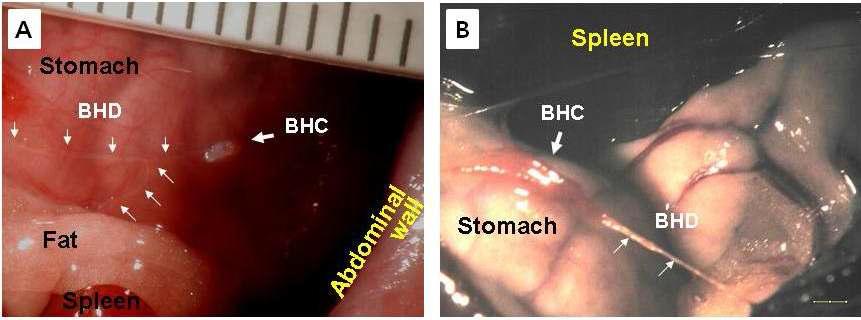 Organ surface primo-vascular tissues in Saline (A) and Phenylhydrazine Group (B).