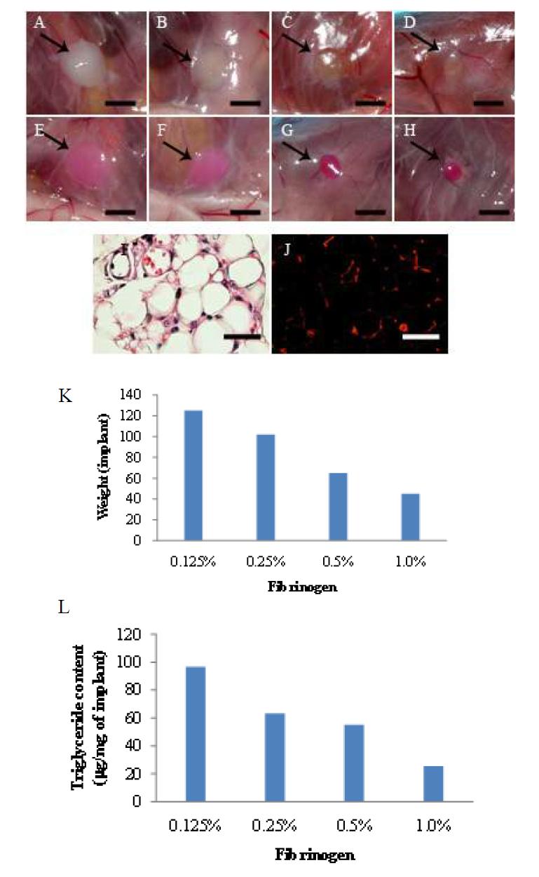 In vivo tissue formation after implantation of ex vivo cultured MSCs-AT encapsulated within 4 types of fibrin hydrogel prepared with 0.125, 0.25, 0.5, and 1.0% fibrinogen. MSCs-AT within fibrin hydrogel was induced into adipogenic lineage for 1 week and MSCs-AT and fibrin were implanted into nude mice. For in vivo tracking, MSCs-AT was labelled with PKH red, encapsulated within fibrin, differentiation induced into adipogenic lineage, and implanted into nude mice. After 1 week of implantation, tissue was formed (A-H). K-L; Weight and triglyceride contents of implants. A, E; 0.125% fibrinogen, B, F; 0.25% fibrinogen, C, G; 0.5% fibrinogen, D, H; 1.0% fibrinogen. E-H; Tissue formed by MSCs labelled with PKH red and fibrin.