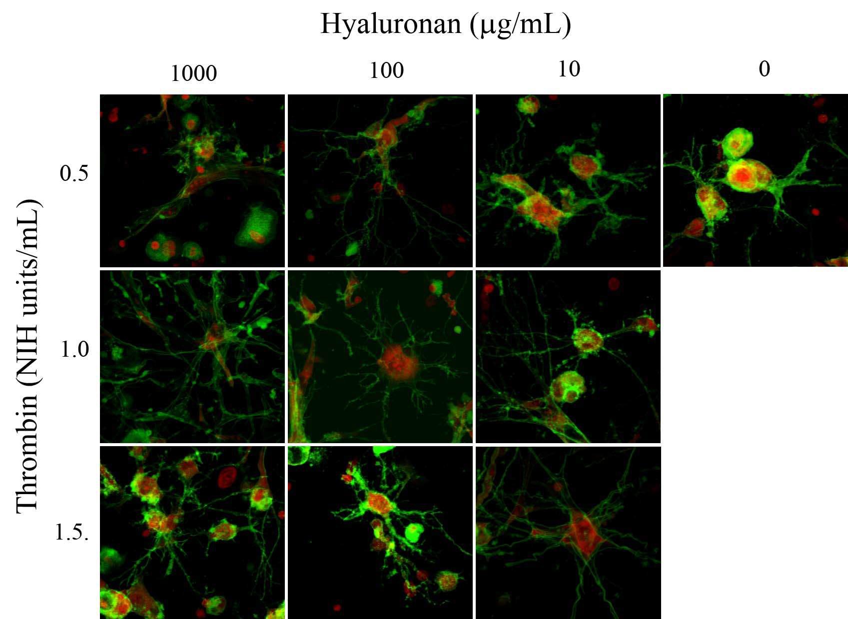 Spreading and filamentous actin (F-actin) organization of adipose-derived stem cells (ASCs) in 3-dimensional (3D) fibrin or fibrin/hyaluronan hydrogel. ASCs were encapsulated within 3D hydrogel and cultured for 24 hours. After fixation with paraformaldehyde, ASCs were labeled with Oregon 488-conjugated phalloidin (Green) and nuclei were stained with propidium iodide (red). Cytoplasmic spreading and F-actin organization were limited in fibrin/hyaluronan hydrogel. ASCs within fibrin hydrogel disclosed well-organized F-actin and cytoplasmic spreading