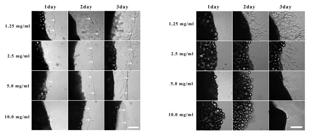 Effect of fibrinogen concentration and aminobenzoic acid (AMBA) on cell outgrowth from adipose tissue. Minced adipose tissue fragments were embedded into fibrin hydrogels prepared with 1.25, 2.5, 5.0, and 10.0 mg/ml of fibrinogen and 0.5 U/ml of thrombin with or without 250 μg/ml AMBA