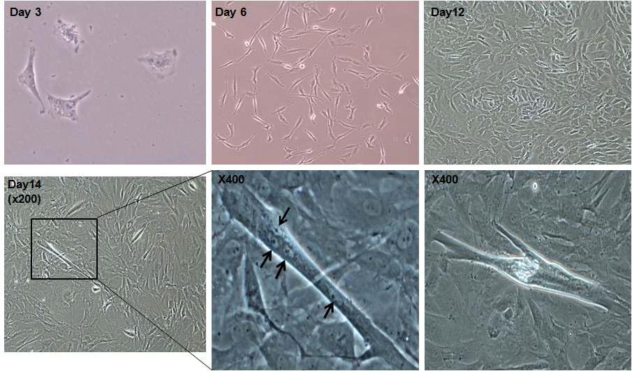 쥐의 초기 근육위성세포의 근육세포로의 분화