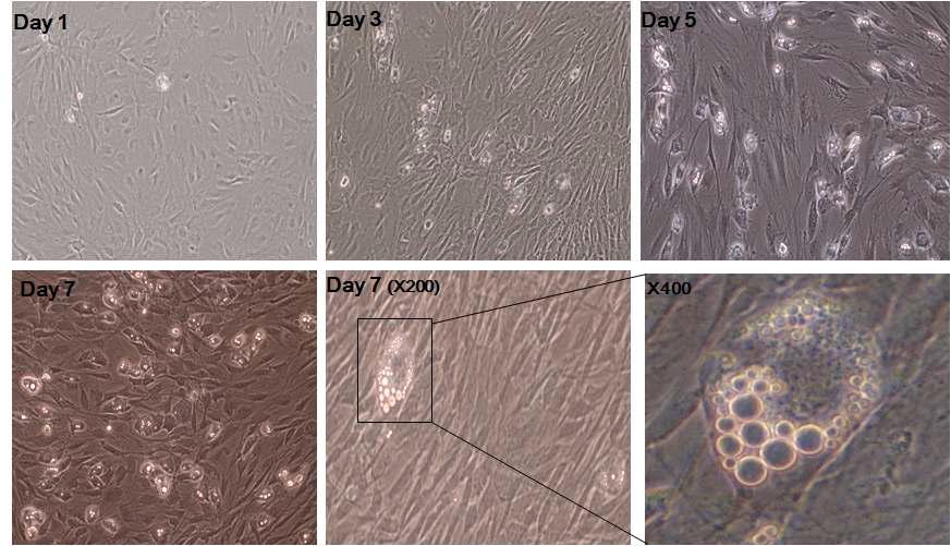 쥐의 초기 근육위성세포의 지방세포로의 분화