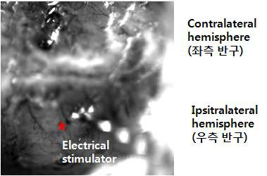 Optical imaging 중에 획득한 이미지 로 양쪽 반구와 electrical stimulator가 나타나 있음