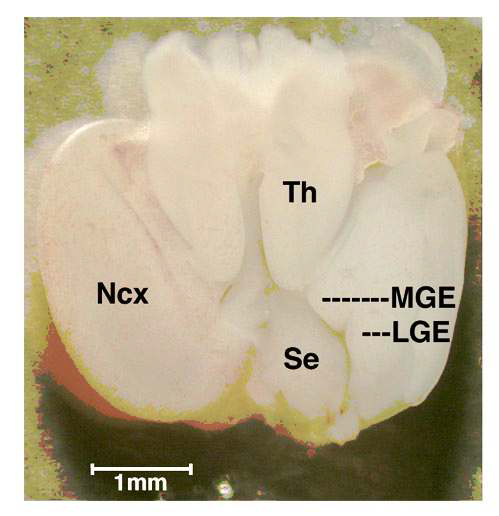 13.5 embryonic day의 배아 두뇌 단면으로 내부에 MGE가 위치함