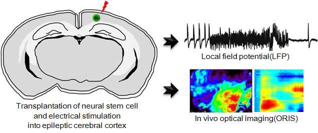 신경 줄기세포의 이식과 동시다발적인 전기자극으로 난치성 간질 대뇌피질의 기능성의 회복을 검증하기 위한 2가지 실험방법
