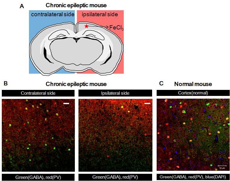 난치성 간질 마우스 모델을 만들기 위해 주입한 FeCl3의 위치가 표시된 것으로 contralateral side(left)와 ipsilateral side(right)를 비교하여 볼 수 있음
