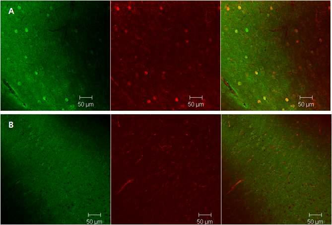 간질 마우스 모델에서 GABA(green), PV(red)로 염색하여 200배율 confocal microscopy로 촬영한 이미지로contralateral hemisphere(A)와 ipsilateral hemisphere(B)에서 각각의 filter에서 촬영한 이미지와 merge 이미지