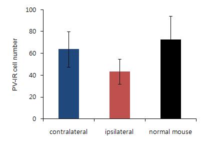 총 12마리의 난치성 간질 모델의 대뇌 피질에서 면역 화학염색을 통해 PV을 발현하는 GABAnergic interneuron을 세서 정량적으로 비교한 것으로, 간질유도제를 주입한 곳에서만 국소적으로 PV-IR(immuno- reactive) cell이 감소한 것을 볼 수 있음