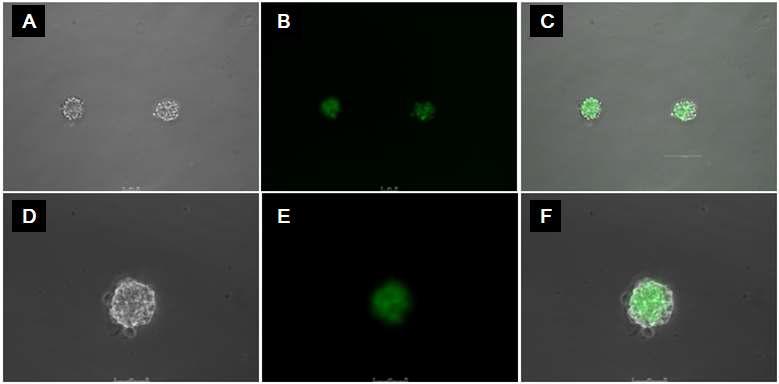 GFP transgenic-mouse에서 추출한 MGE progenitor cell을 proliferation media에 1주일 동안 배양시킨 후에 형성되는 neurosphere