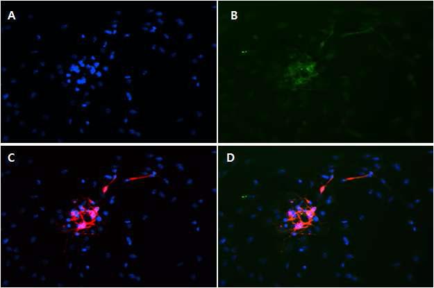 neurosphere를 differentiation media에서 배양한 후에 DAPI, Tuj1, GFAP로 염색한 사진으로 200 배율로 촬영함