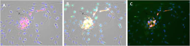 하나의 neurosphere에서 분화하여 이동한 세포들을 immunocytochemisty 방법으로 특정 antibody를 가지고 염색한 것으로 400배율로 촬영하였고 (BF)bright-field에서 찍은 것과 merge한 이미지