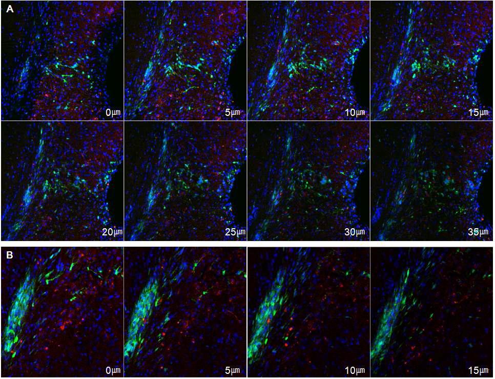 정상 마우스에 신경 줄기세포를 이식한 지 7일 째의 대뇌 피질 모습으로 DAPI(blue)를 이용하여 대뇌 피질의 전체적인 구조를 볼 수 있으며, 세포의 이동을 분석하기 위해 z-stack 공초점 현미경을 이용하여 5㎛ 간격으로 촬영으로 하였음.