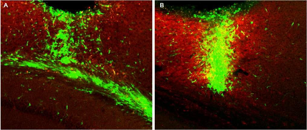 대뇌 피질에 GFP-MGE progenitor cel(green)l을 이식한지 DAT07일 째 되는 모습으로 PV(red)와 함께 staining하여 보여줌