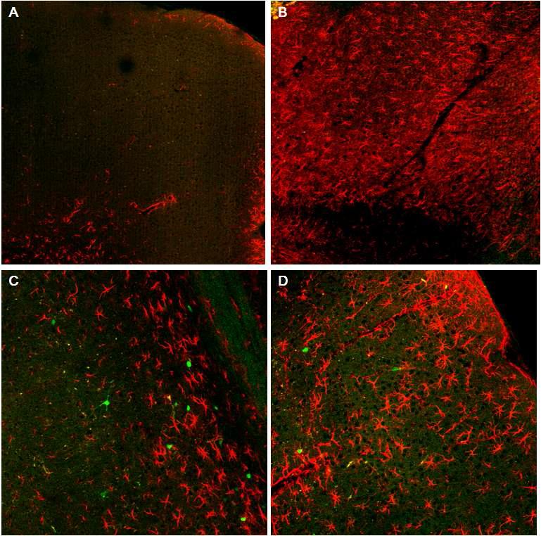 Glial cell을 염색하는 GFAP를 이용하여 glial cell과 MGE progenitor cell의 연관관계를 조사함