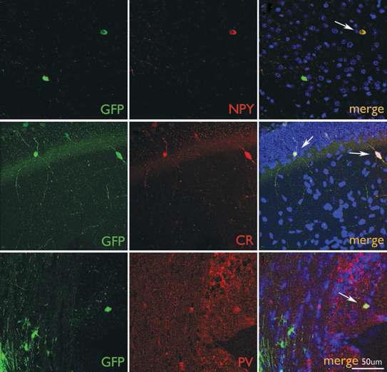 Immunohistochemistry of brain slices from MGE-grafted mice after MES (2 months after transplantation)