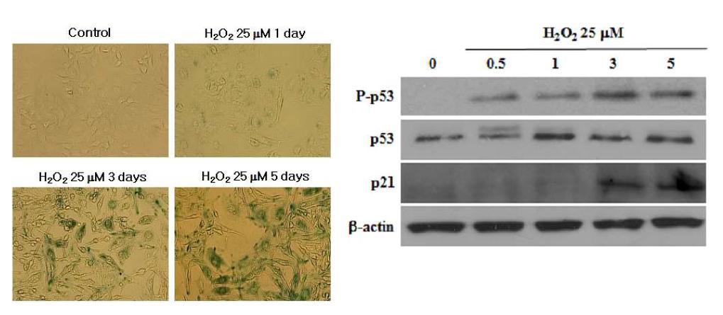 Cellular senescence causes p53 phosphorylation and p21 expression in HEI-OC1 cells. (Right) Cells were pretreated with luteolin for 12 h and then incubated with 25 μM H2O2 for 3 days. (Right) Cells were incubated with 25 μM H2O2 for 0.5, 1, 3, and 5 days. Western blot analysis was performed using specific antibodies