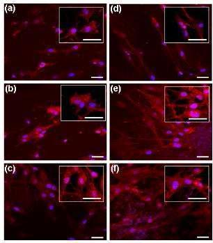 세포점착 테스트. 면역형광염색법으로 F-actin을 염색한 MC3T3 osteo-like cell