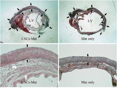 CSC-mat의 MI 동물 모델 이식 2주 후 현미경 사진.