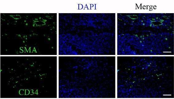 rat의 MI 모델에 CSC-mat을 이식 후 2주 CSC-mat내 혈관 생성의 확인. SMA와 CD34는 각각 대혈관과 소혈관 생성을 나타냄.
