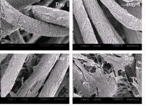 GDF-5와 1,25-dihydroxyvitamin D3를 로딩한 PLLA 지지체에서 hASC를 1,3,7,10일간 배양한 SEM 사진(×200)