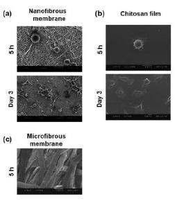 키토산 멤브레인에서 배양한 연골세포의 SEM 사진.
