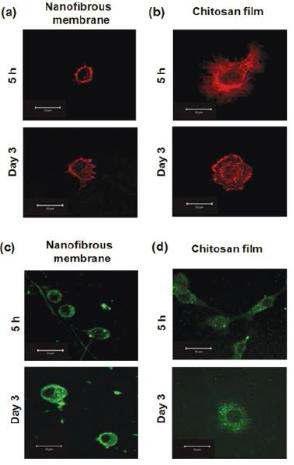 키토산 나노섬유 멤브레인이 연골세포 배양에 미치는 영향. 제작한 키토산 멤브레인에서 배양된 연골세포의 F-actin과 typeⅡ 콜라겐의 형광 사진.