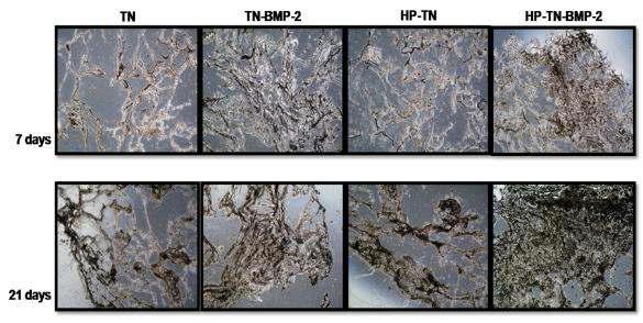 von Kossa staining을 이용한 PLA/gelatin 나노섬유/micro-porous 복합 지지체에서 osteoblast로 분화한 hMSCs가 분비하는 미네랄 분석