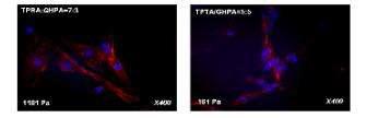 F-actin 형광 염색을 통한 TPTA/GHPA 하이드로젤의 세포 성장평가