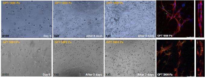 젤라틴 하이드로젤을 기계적 강도에 따른 human dermal fibroblast의 3D 세포 성장 거동