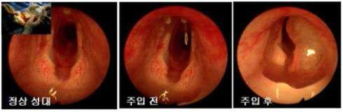 연골 조직 재생 유도를 통한 성대 재생 실험