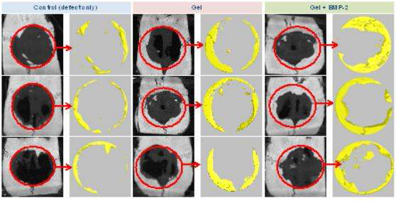 젤라틴 하이드로젤의 골 재생능 micro-CT 결과